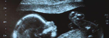 ultrasound for ovulation control