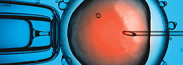 intra cytoplasmic sperm injection - icsi